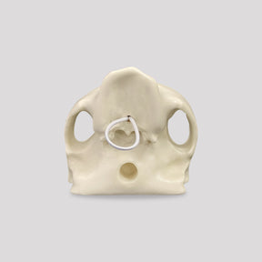 4017 - EDENTULOUS MAXILLA