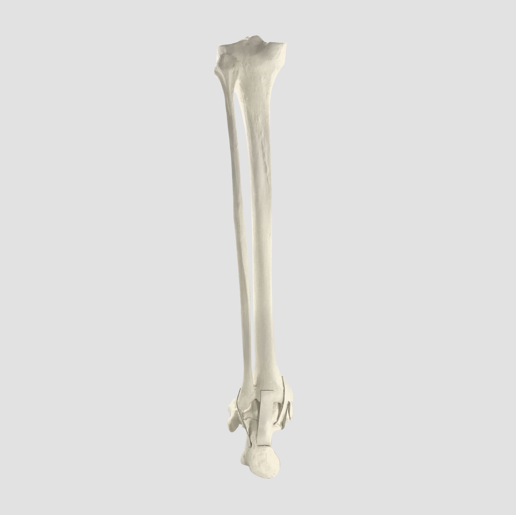 2026PI-01 - LEFT ANKLE - TIBIA, FIBULA AND FOOT