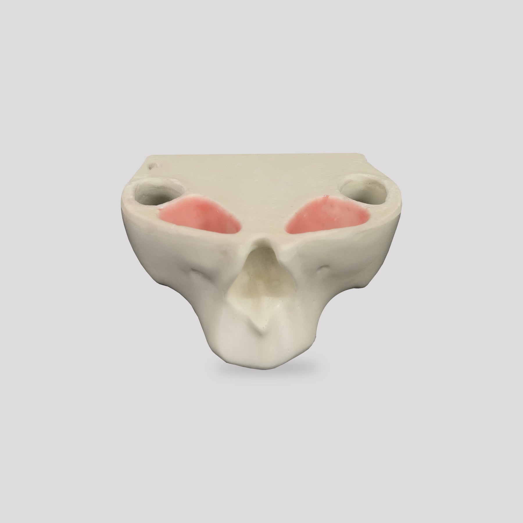 4017 - EDENTULOUS MAXILLA