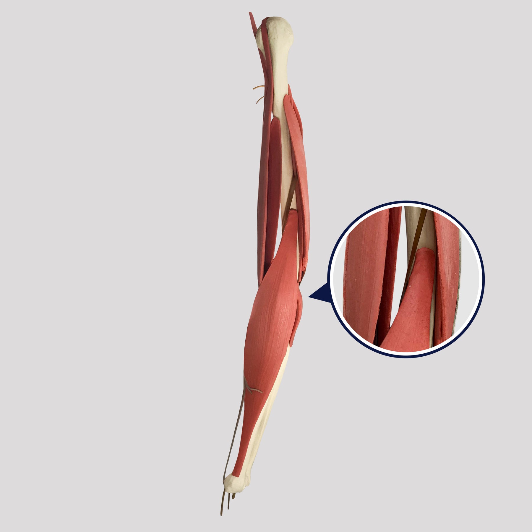 11309 - LEFT ELBOW WITH COMPLETE STRUCTURES