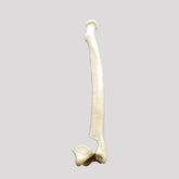 10054 - LEFT RADIUS W/ DISTAL FRACTURE INTRA ARTICULAR W/ DEVIATION