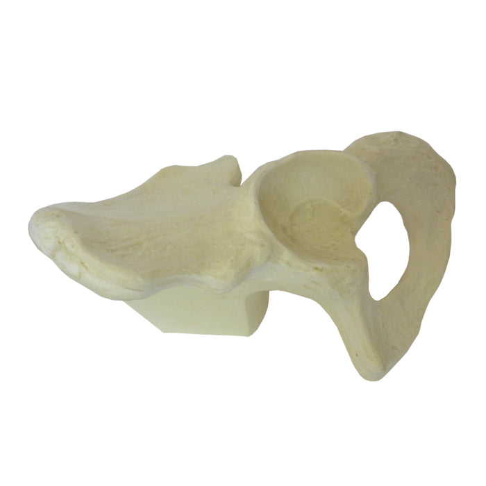 1007 - LEFT PELVIS WITH HOLDING BLOCK