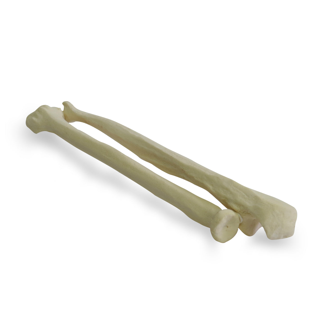 12338 - RADIOPAQUE RIGHT FOREARM