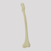 12413 - CHILDREN'S RIGHT RADIOPAQUE FEMUR WITH CHANNEL AND ANTEVERSION DEFORMITY