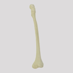 12413 - CHILDREN'S RIGHT RADIOPAQUE FEMUR WITH CHANNEL AND ANTEVERSION DEFORMITY