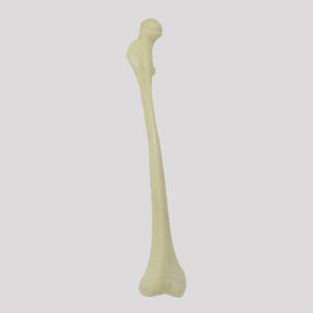 12413 - CHILDREN'S RIGHT RADIOPAQUE FEMUR WITH CHANNEL AND ANTEVERSION DEFORMITY