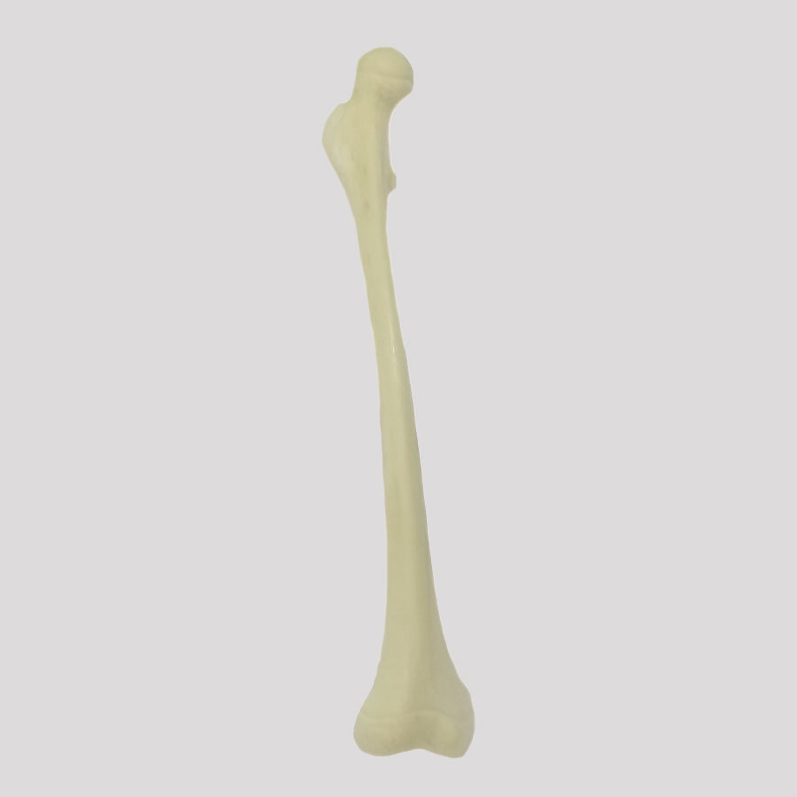 1018 - CHILD RIGHT FEMUR WITH CANAL AND ANTEVERSION DEFORMITY