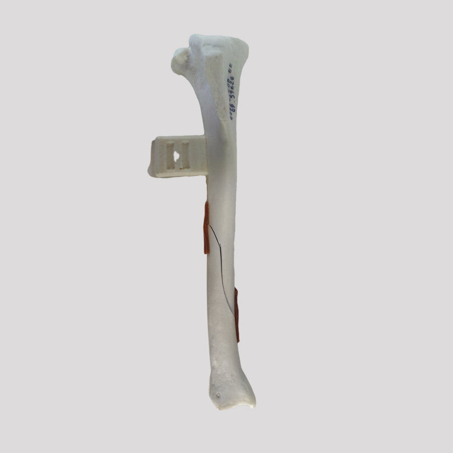 10492 - RIGHT CANINE TIBIA WITH OBLIQUE MIDSHAFT FRACTURE