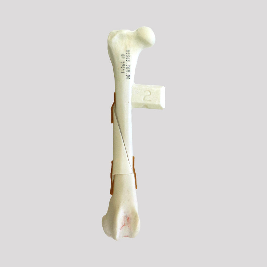 10493 - RIGHT FEMUR CANINE WITH BUTTERFLY AND TRANSVERSE FRACTURES