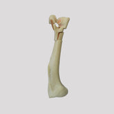 10513 - HUMERUS WITH FRACTURE INTER/ SUPRACONDYLAR - CANINE