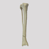 10515 - TIBIA WITH DISTAL OBLIQUE FRACTURE - CANINE