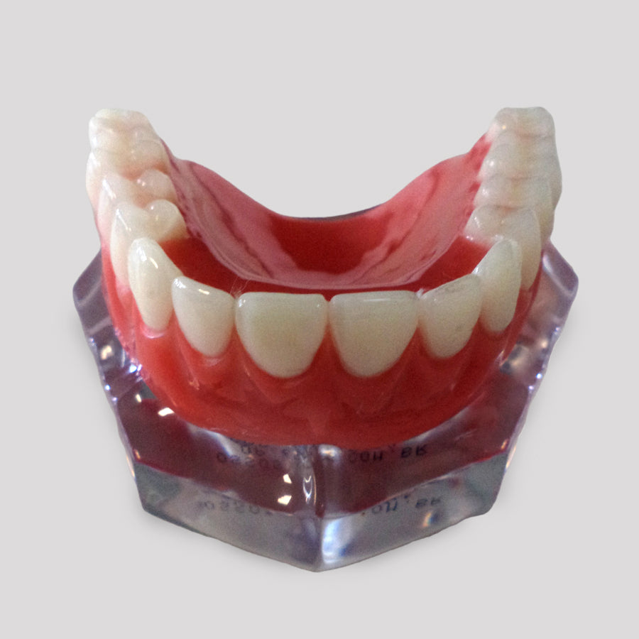 10981 - ACRYLIC MAXILLA WITH 3 CLIP BARS AND PROSTHESIS