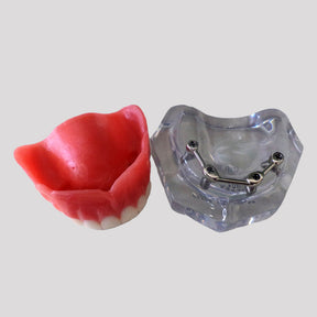 10981 - ACRYLIC MAXILLA WITH 3 CLIP BARS AND PROSTHESIS