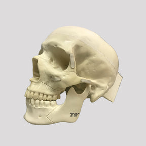 10985  SKULL WITH ZYGOMATIC FRACTURE AND SUPPORT BLOCK