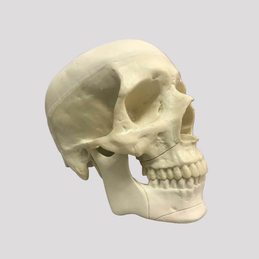 10986 - SKULL WITH LE FORT FRACTURE AND SUPPORT BLOCK