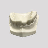 12232 - MAXILLA WITH FRACTURE IN TOOTH 11 FOR PREPARATION