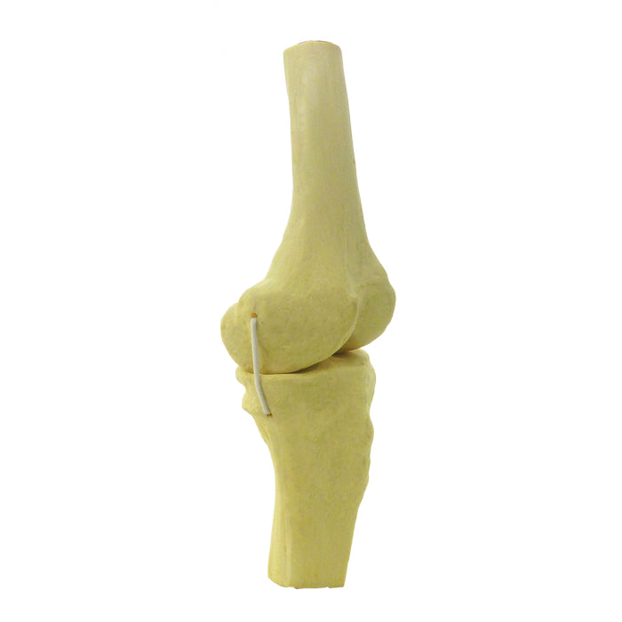 12382 - LEFT RADIOPAQUE KNEE AND COLLATERAL LIGAMENTS