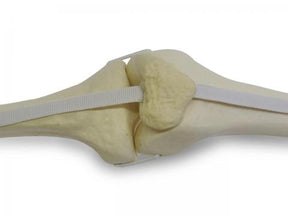 12386 - LEFT RADIOPAQUE KNEE WITH CANCELLOUS MEDULLARY CANAL AND LIGAMENT + PATELLA SIMULATION