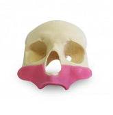 9014G - FRONTAL SKULL - ALL ON 4 - ZYGOMATIC IMPLANT WITH GUM