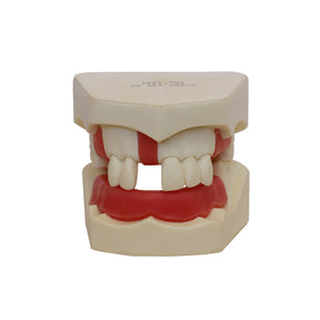 4200 - BASIC MODEL WITH SOME TEETH AND PARTIAL GUM