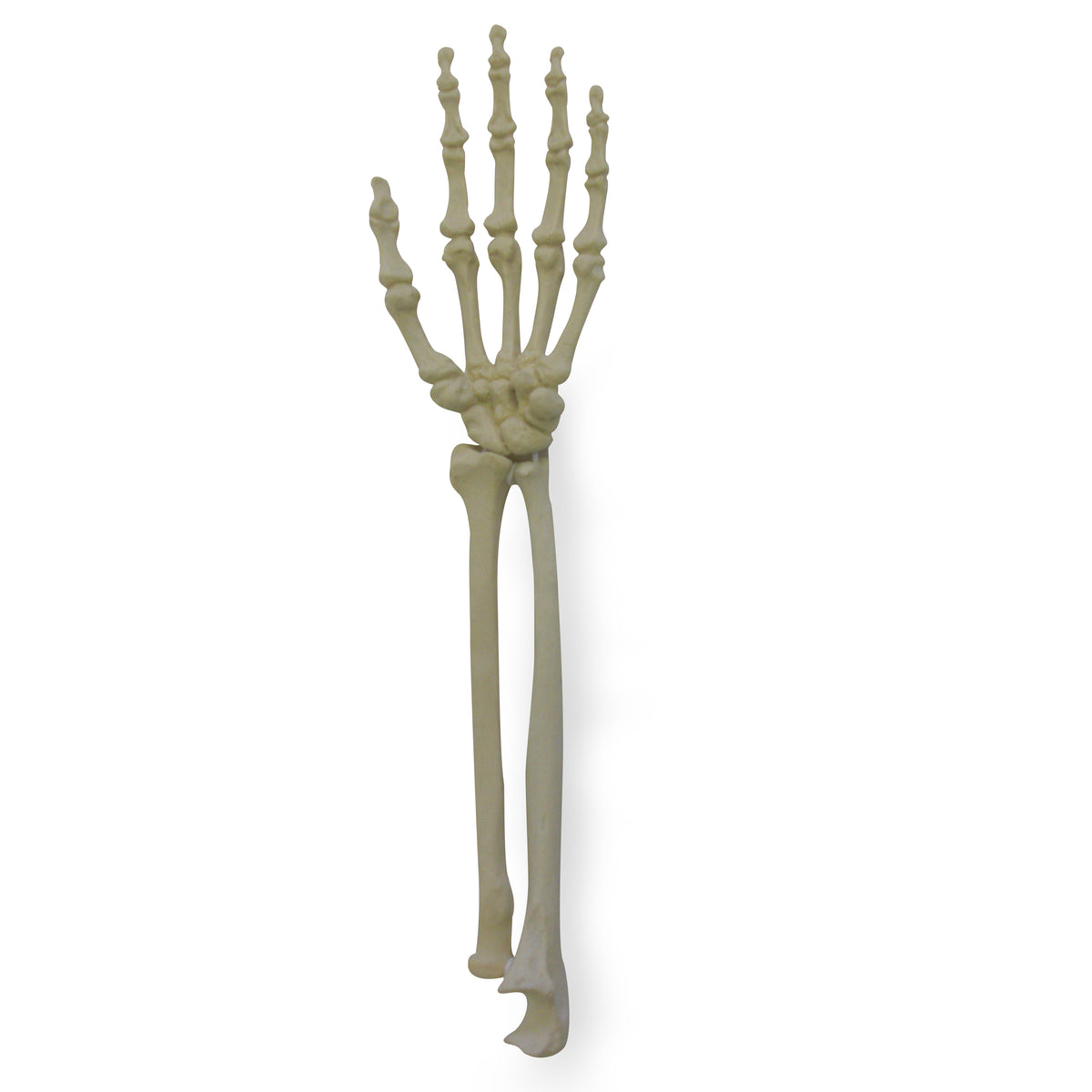12344 - RADIOPAQUE LEFT WRIST