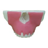 4051G - MAXILLA WITH PERIODONTAL GUM AND RECESSION