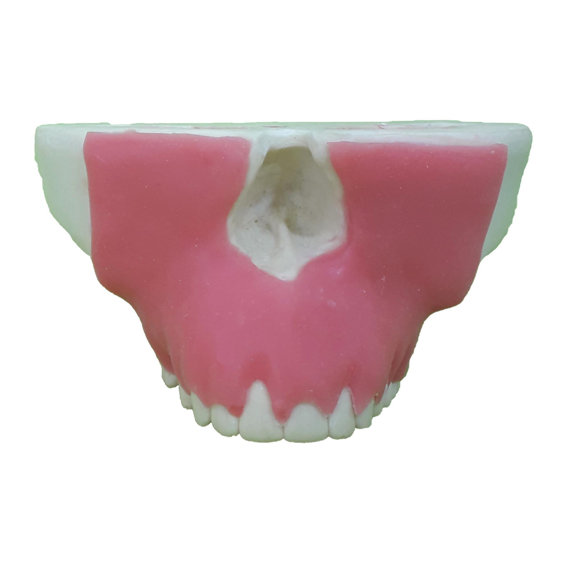 4051G - MAXILLA WITH PERIODONTAL GUM AND RECESSION