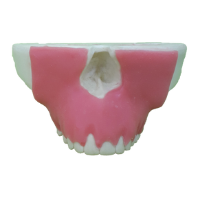 4051G - MAXILLA WITH PERIODONTAL GUM AND RECESSION