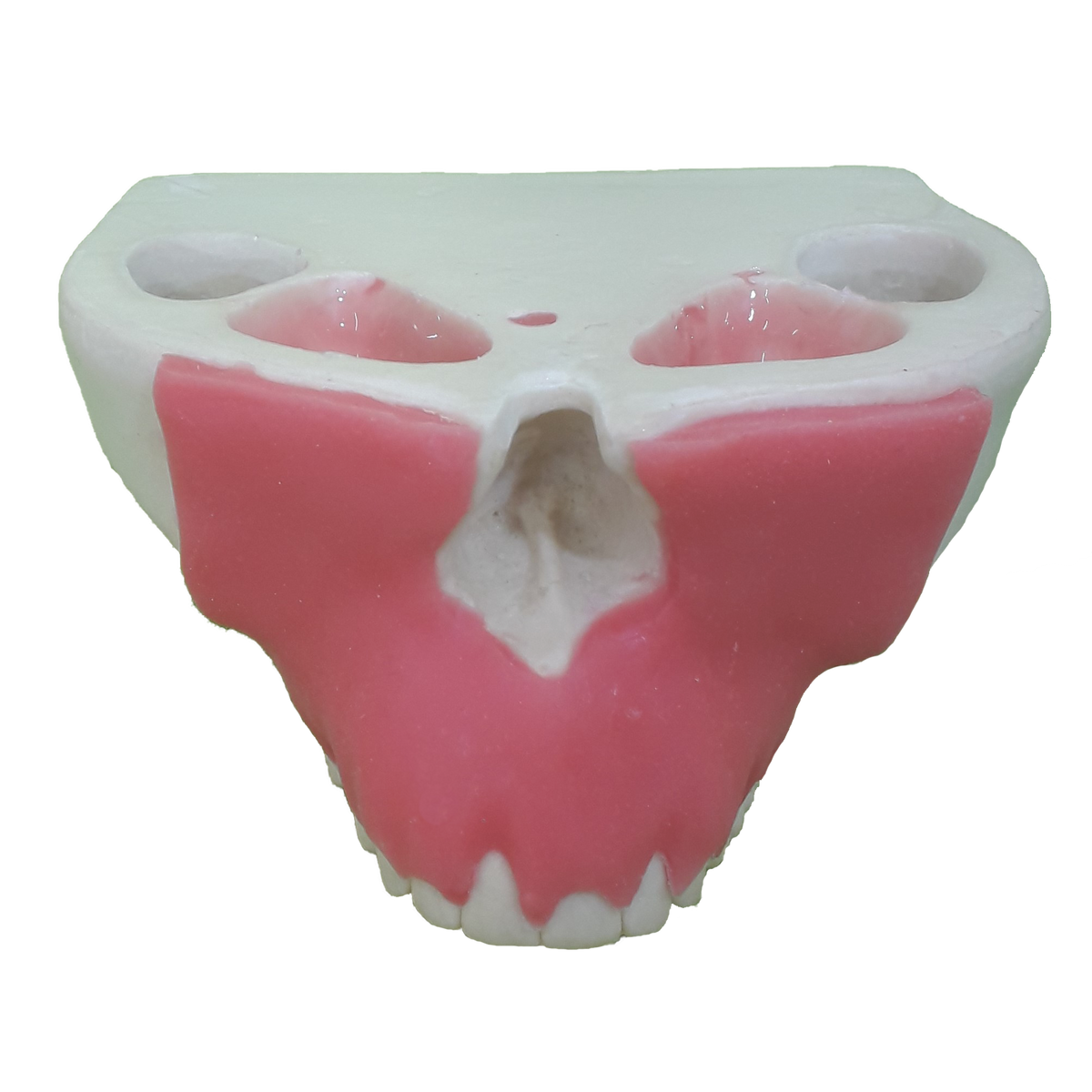 4051G - MAXILLA WITH PERIODONTAL GUM AND RECESSION