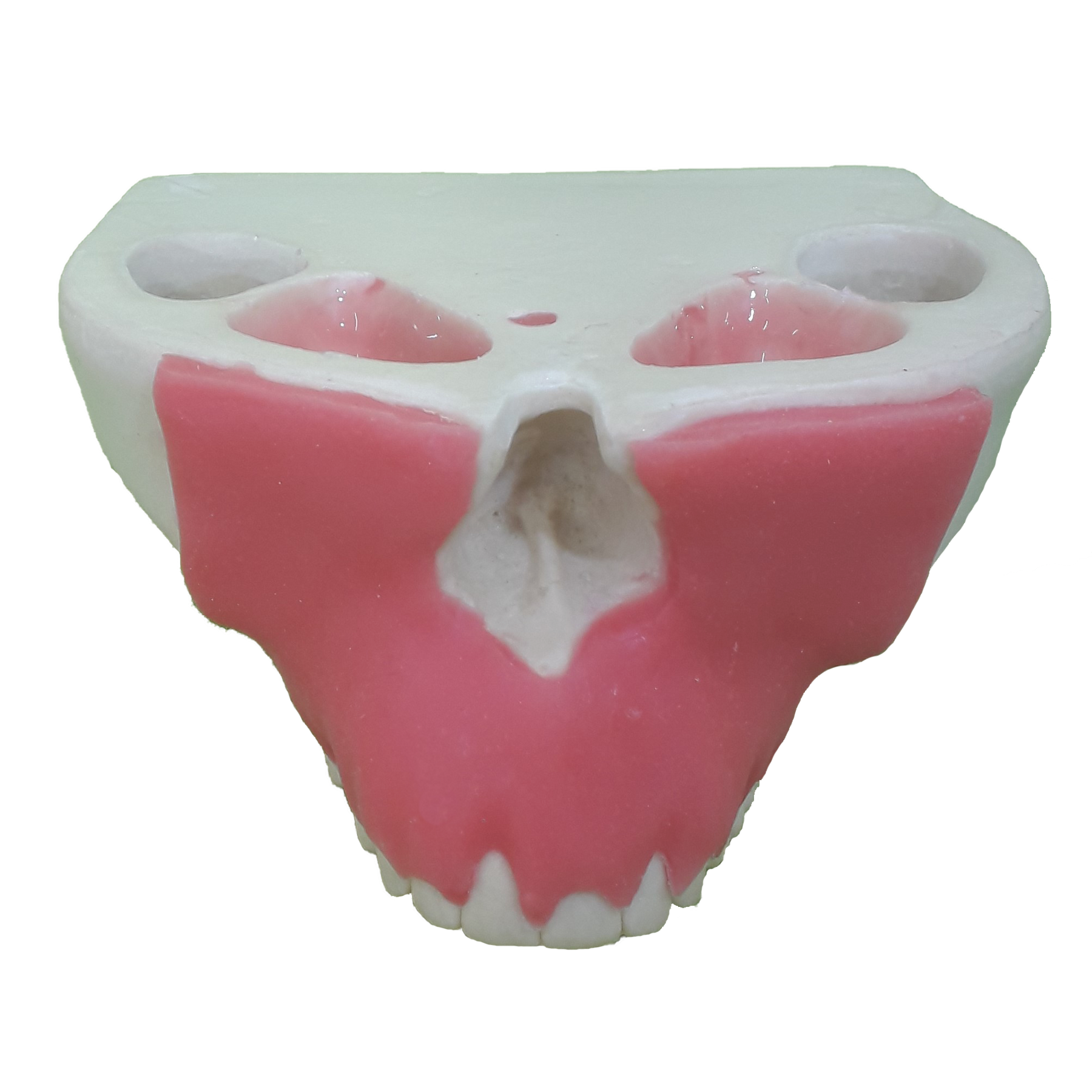 4051G - MAXILLA WITH PERIODONTAL GUM AND RECESSION