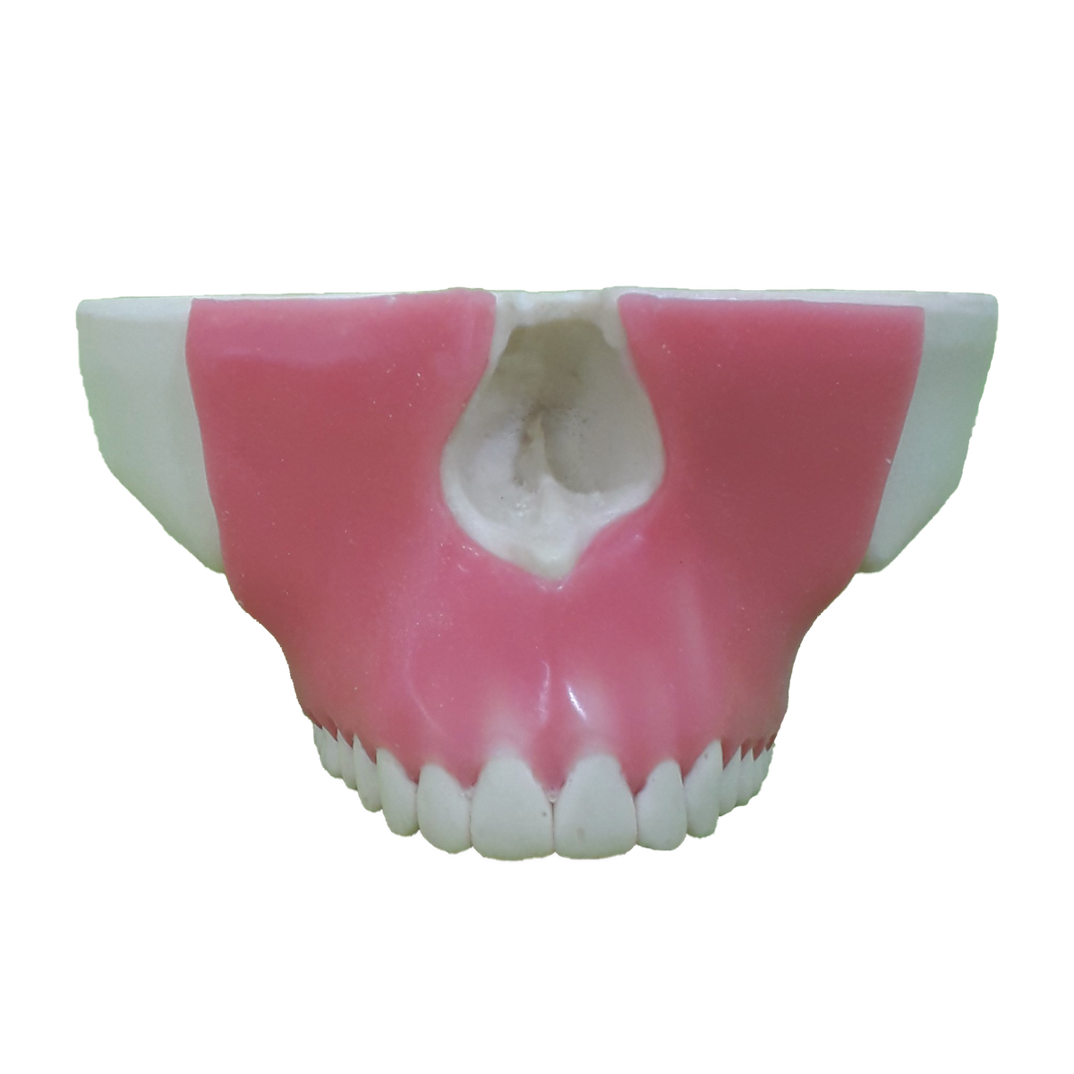 4016G - MAXILLA WITH ALL TEETH AND GUM