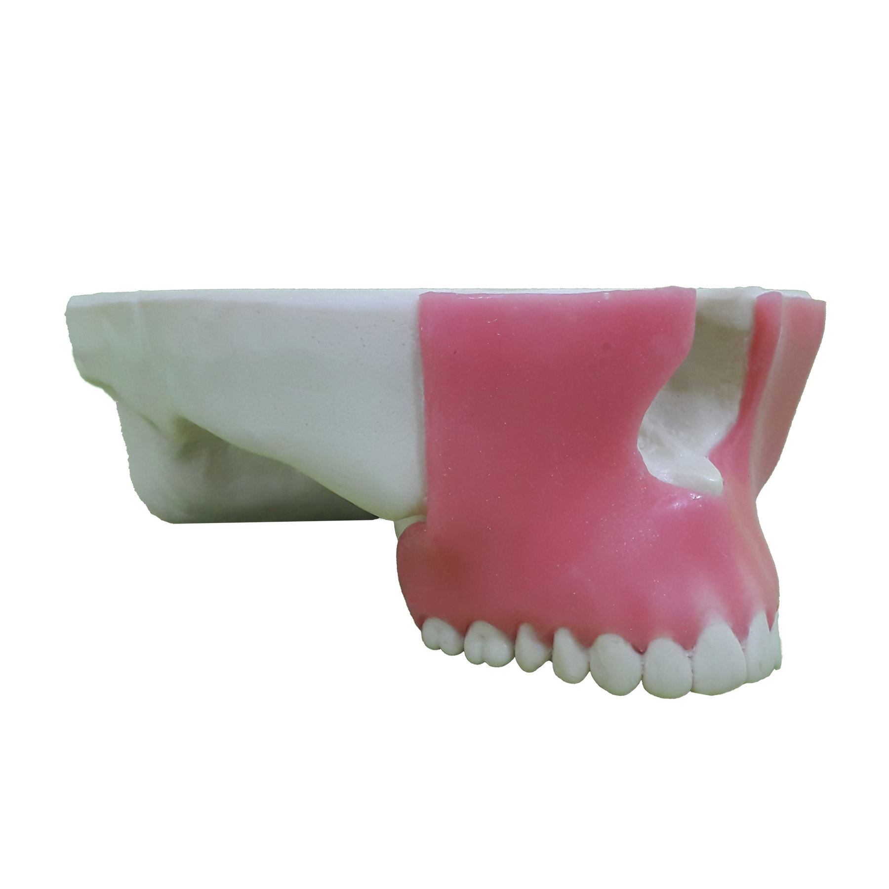 4016G - MAXILLA WITH ALL TEETH AND GUM