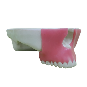 4016G - MAXILLA WITH ALL TEETH AND GUM