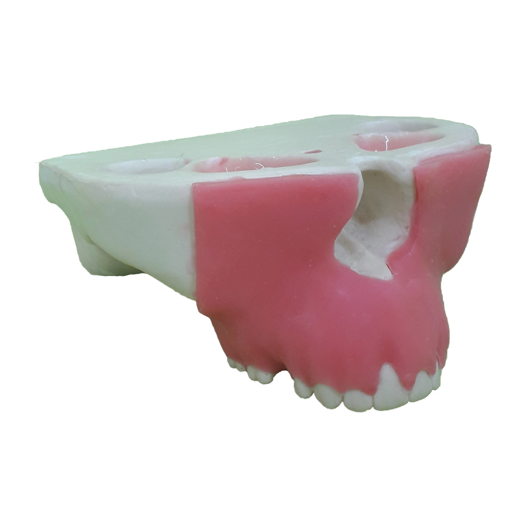 4051G - MAXILLA WITH PERIODONTAL GUM AND RECESSION