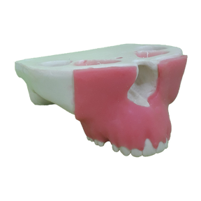 4051G - MAXILLA WITH PERIODONTAL GUM AND RECESSION