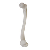 2025 RVD - LEFT FEMUR DOUBLE VARUS RICKETS