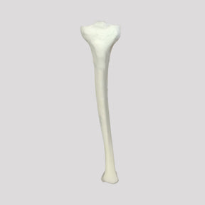 12375 - RADIOPAQUE LEFT TIBIA WITH CANCELLOUS MATERIAL AND MEDULLARY CANAL