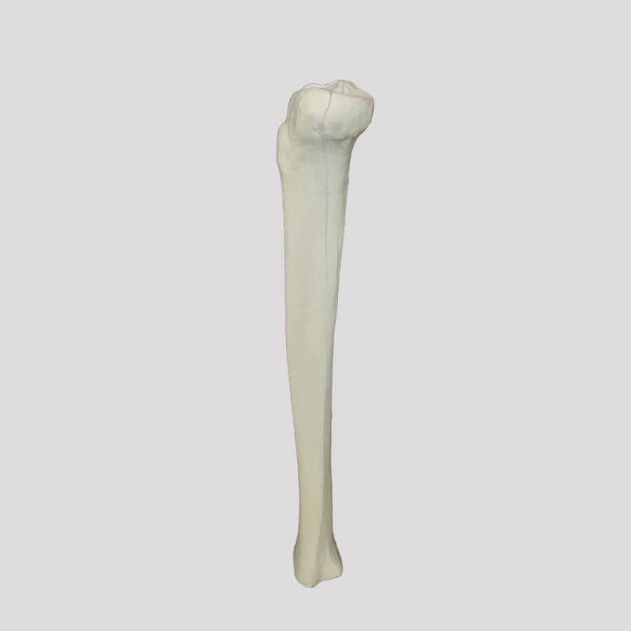 12375 - RADIOPAQUE LEFT TIBIA WITH CANCELLOUS MATERIAL AND MEDULLARY CANAL