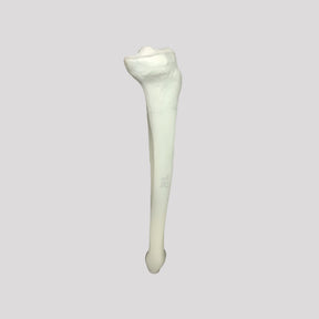 12375 - RADIOPAQUE LEFT TIBIA WITH CANCELLOUS MATERIAL AND MEDULLARY CANAL