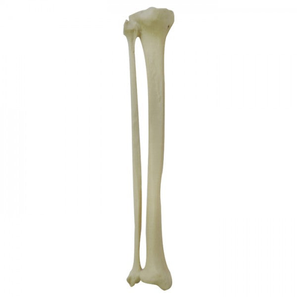 12376 - RADIOPAQUE LEFT TIBIA WITH CANCELLOUS MATERIAL AND MEDULLARY CANAL + FIBULA