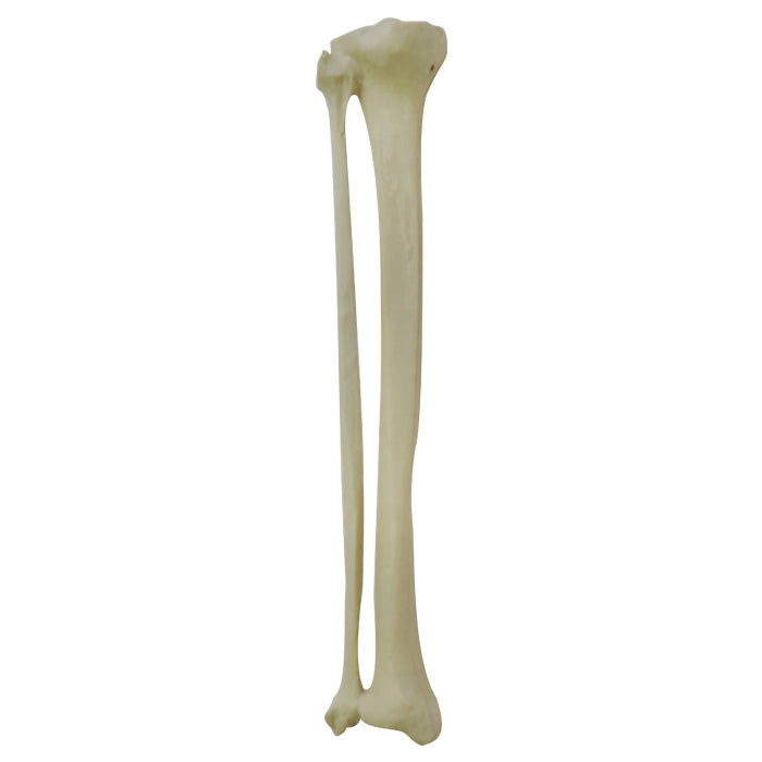 2026BESP-1 - LEFT TIBIA WITH CANCELLOUS MATERIAL AND MEDULLARY CANAL + FIBULA