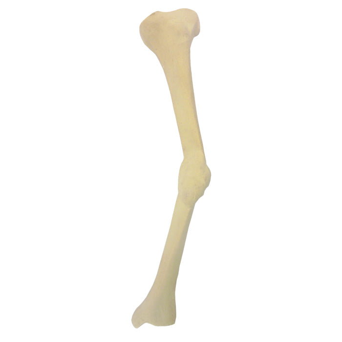 2026 DMMC - LEFT TIBIA W/ MEDIAL DEFORMITY AND POOR CALCIFICATION