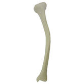 2026DMVR - LEFT TIBIA WITH MEDIAL VARUS DEFORMITY