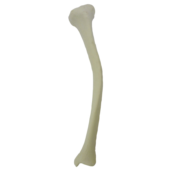 12447 - LEFT TIBIA WITH MEDIAL VARUS DEFORMITY