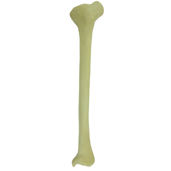 12450 - LEFT TIBIA WITH PROXIMAL VARUS DEFORMITY AND INTERNAL ROTATION
