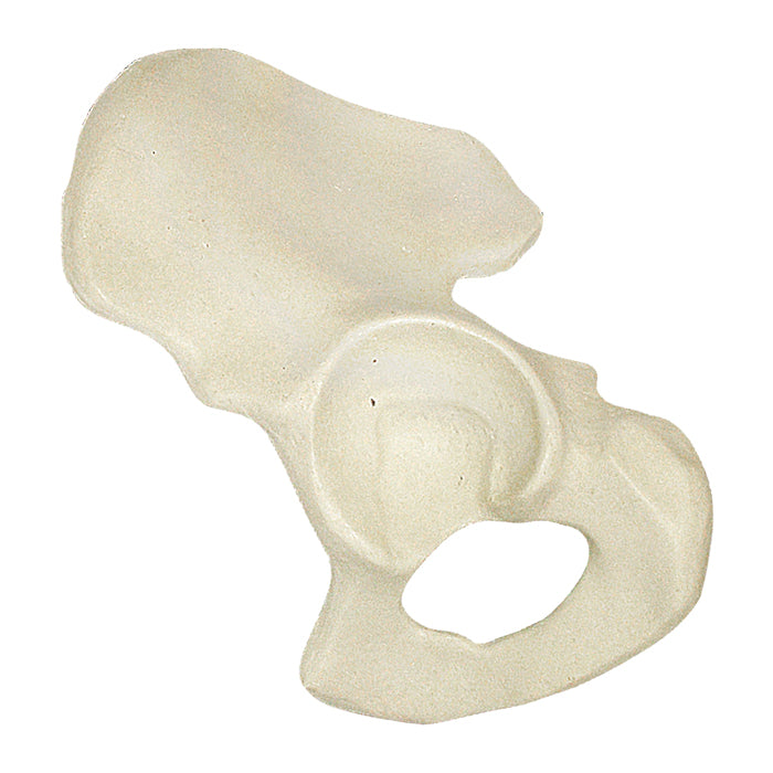 2027B - LEFT RADIOPAQUE PELVIS