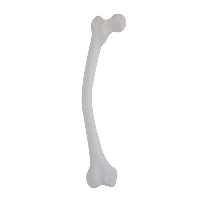 2030D2P-MAVR - RIGHT FEMUR WITH DOUBLE-LEVEL MEDIAL ANTERIOR VARUS DEFORMITY