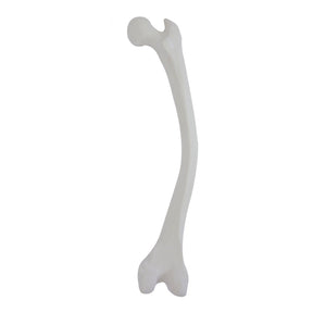 12417 - RIGHT FEMUR WITH DOUBLE-LEVEL MEDIAL ANTERIOR VARUS DEFORMITY