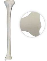 12372 - RADIOPAQUE RIGHT TIBIA WITH CANCELLOUS MATERIAL AND MEDULLARY CANAL