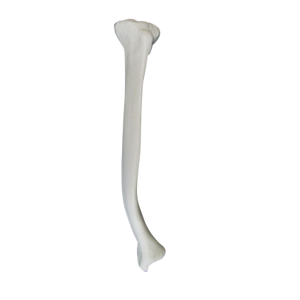 12436 - RIGHT TIBIA WITH DISTAL DEFORMITY